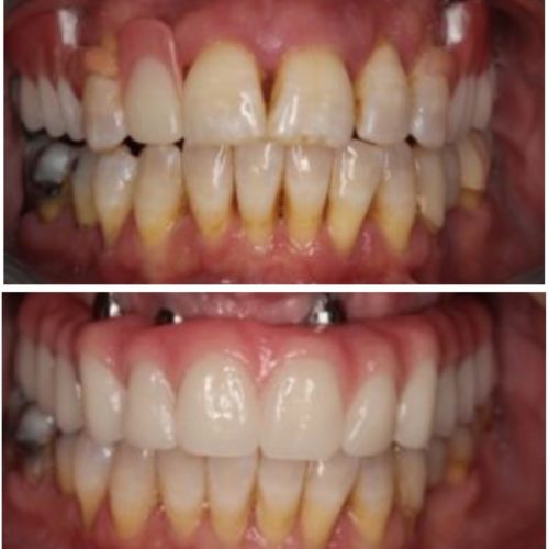 After dental care at The Office of Dr. Bellisario