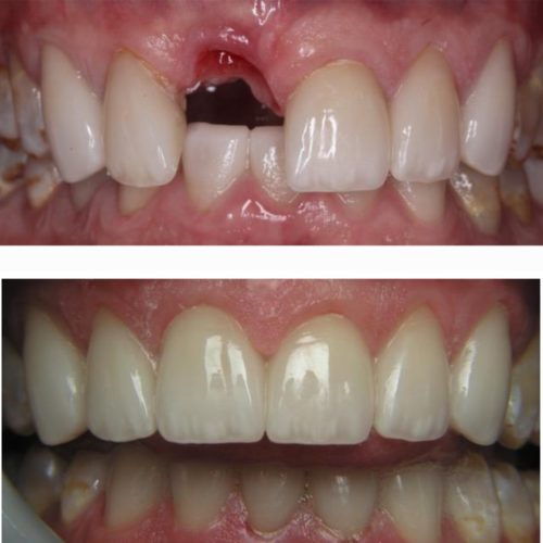 After dental care at The Office of Dr. Bellisario