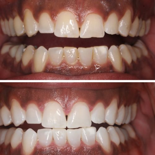 After dental care at The Office of Dr. Bellisario