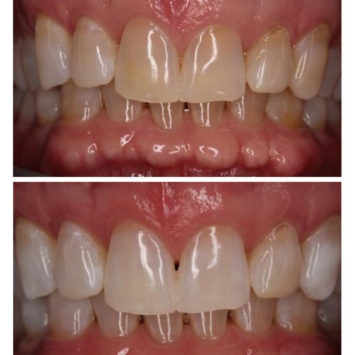 After dental care at The Office of Dr. Bellisario