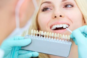 porcelain veneers aftercare