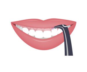 Laser dentistry offers numerous benefits that often enhance patient comfort and treatment outcomes during their appointment.