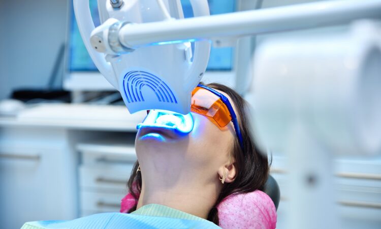 Professional teeth whitening remains the most effective and safest way to achieve a truly radiant and healthy smile.