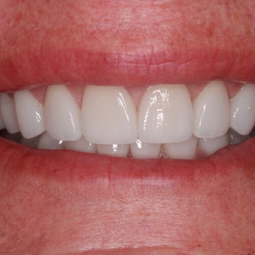 After dental care at The Office of Dr. Bellisario