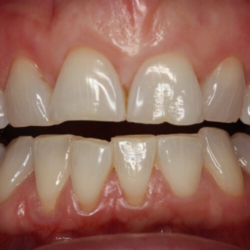 Before dental care at The Office of Dr. Bellisario
