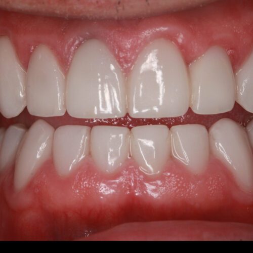 After dental care at The Office of Dr. Bellisario