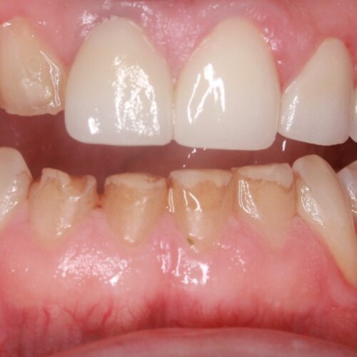Before dental care at The Office of Dr. Bellisario
