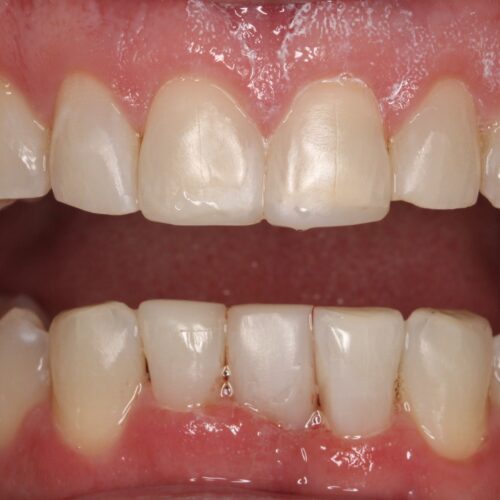 After dental care at The Office of Dr. Bellisario