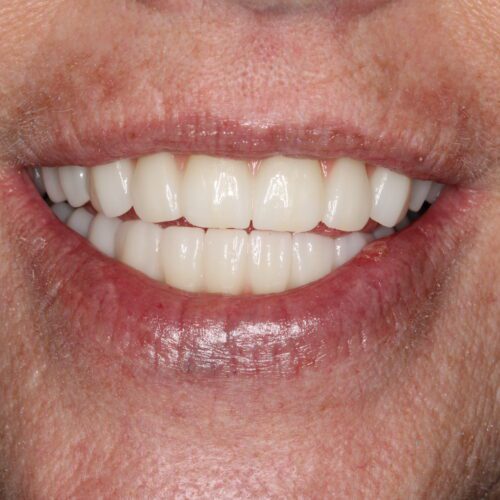 After dental care at The Office of Dr. Bellisario