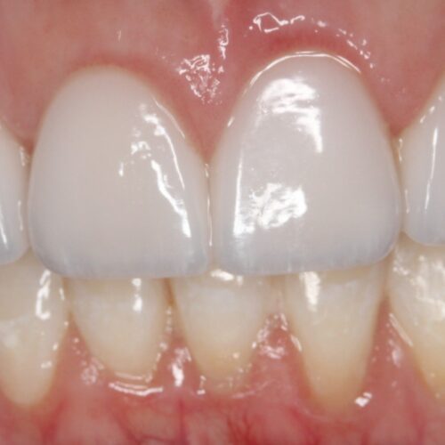 After dental care at The Office of Dr. Bellisario