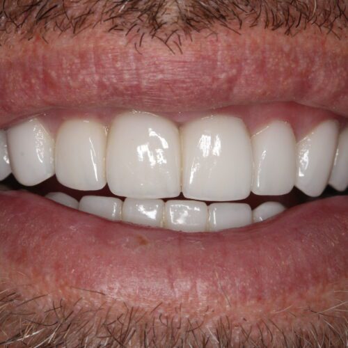 After dental care at The Office of Dr. Bellisario