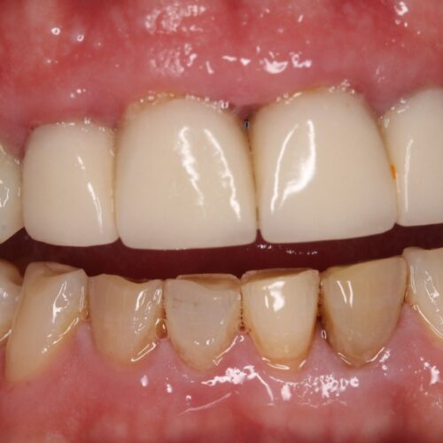 Before dental care at The Office of Dr. Bellisario