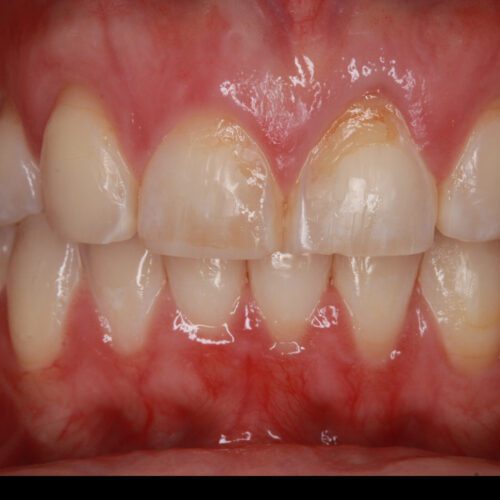 Before dental care at The Office of Dr. Bellisario