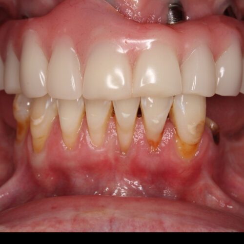 Before dental care at The Office of Dr. Bellisario